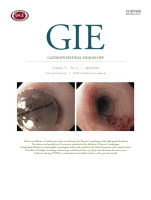 gastrointestinal-endoscopy-1004